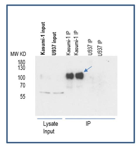 Anti-AML1-ETO | ABC1411-100UL