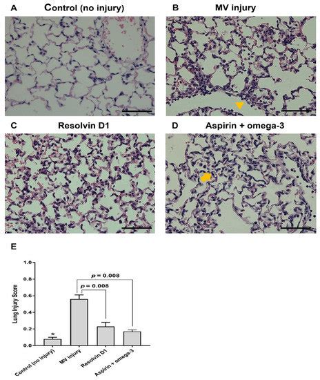Simultaneous Pretreatment of Aspirin and Omega-3 Fatty Acid Attenuates ...