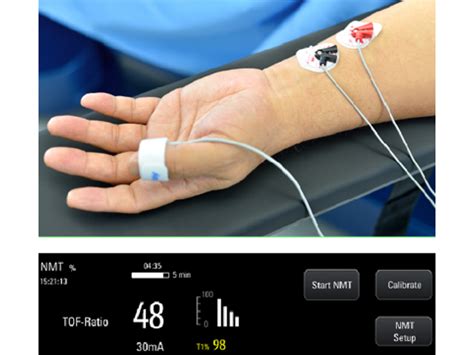 Patient Monitoring | Anesthesia Machine | A7 Workstation - Mindray India