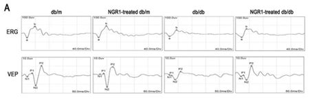 Notoginsenoside R1 Ameliorates Diabetic Retinopathy through PINK1 ...