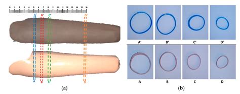 Affordable and Faster Transradial Prosthetic Socket Production Using ...