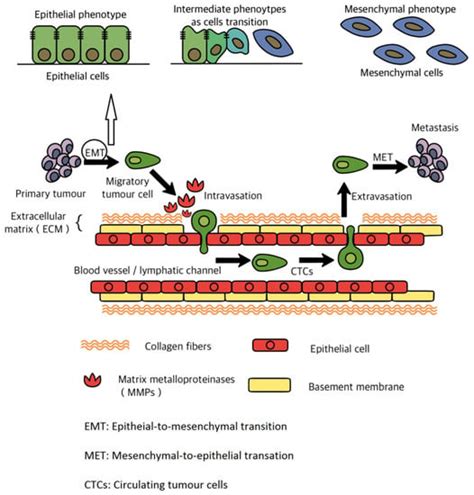 Breast Cancer Bone Metastasis: A Narrative Review of Emerging Targeted ...