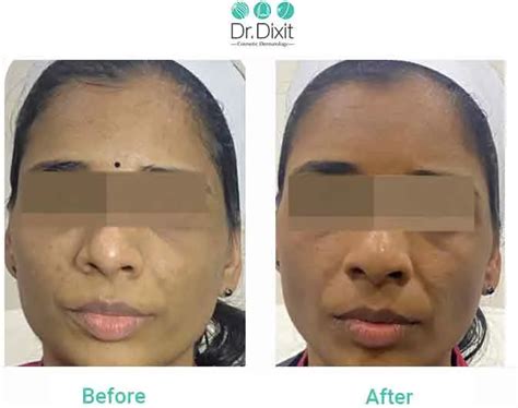 Real Results | Before and After Treatment