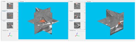 Investigating the Behaviour of Machine Learning Techniques to Segment ...
