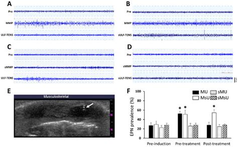 IJMS | Special Issue : Orofacial Pain: Molecular Mechanisms, Diagnosis ...