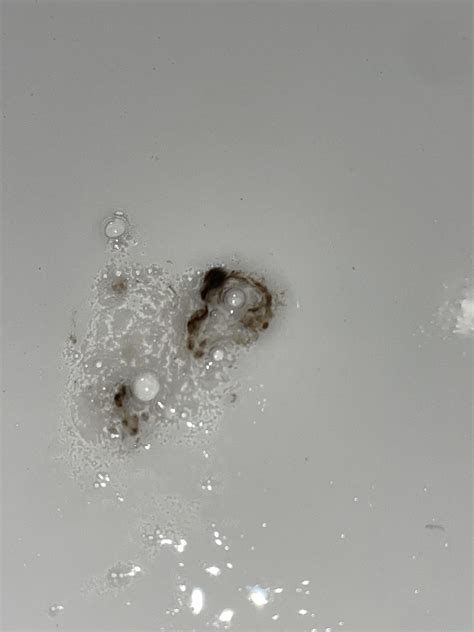 Dark Brown blobs in Phlegm. : r/medical_advice