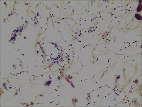 Gram s crystal violet solution, for microscopy