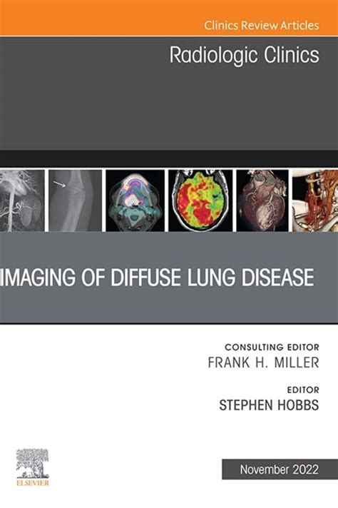 Imaging of Diffuse Lung Disease, An Issue of Radiologic Clinics of ...