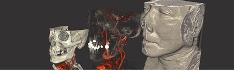 Image result for MeVisLab Features