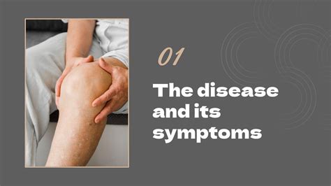 Image result for Soft Tissue Sarcoma Hand