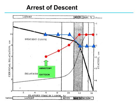 S13 Abnormal labor obstetrics and gynecology.ppt