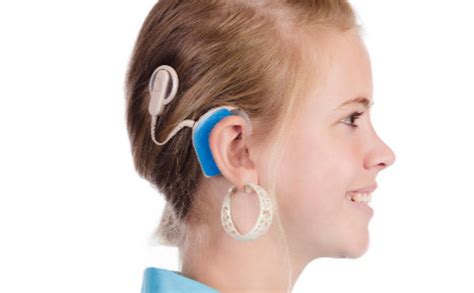 人工耳蜗听力能达到多少分贝（做了人工耳蜗还有残余听力吗）-坤知百科