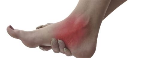 Pin on swollen feet remedies