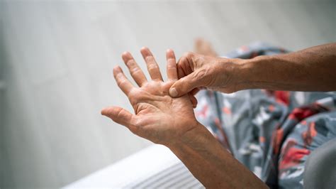 Understanding Dupuytren’s Contracture: Causes, Symptoms, and Treatments