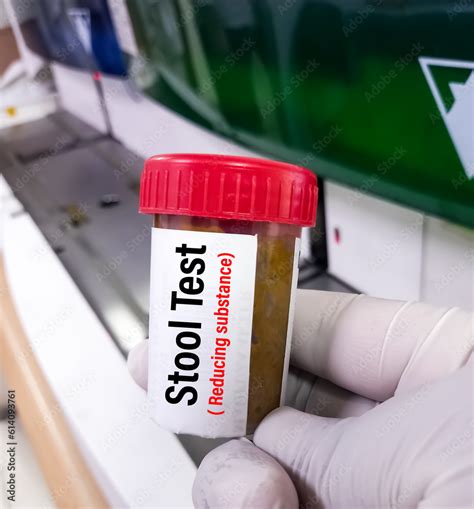 Image result for Stool Sample Test Results