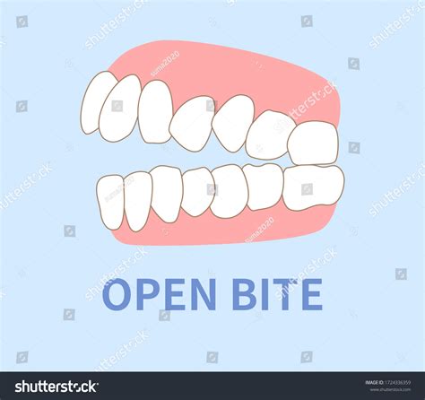 Visit Carmel Pediatric Dentistry in Carmel, IN