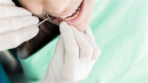 Image result for Pulled Tooth