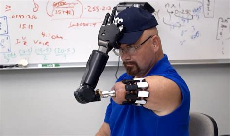 Image result for Bionic Arm Prosthetics