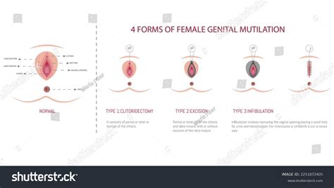 Image result for Mutilation Examples