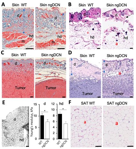 Glycosaminoglycan Modification of Decorin Depends on MMP14 Activity and ...