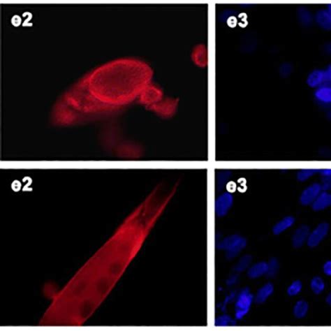 Image result for Muscle Spindle