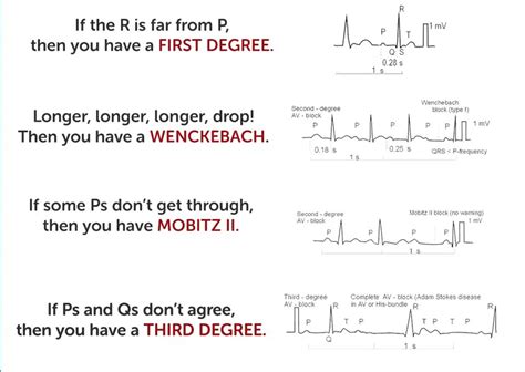 Types Of Heart Block Poem at Willie Davin blog