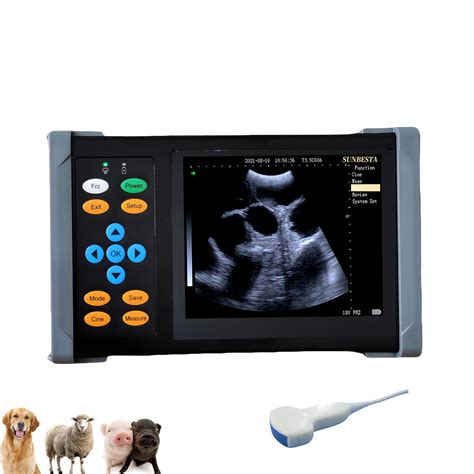 Amazon.com: SUNBESTA A20 Portable Ultrasound Machine for Pregnancy, at Home Ultrasound Machine ...