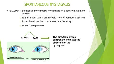 Assessment of vestibular system | PPTX