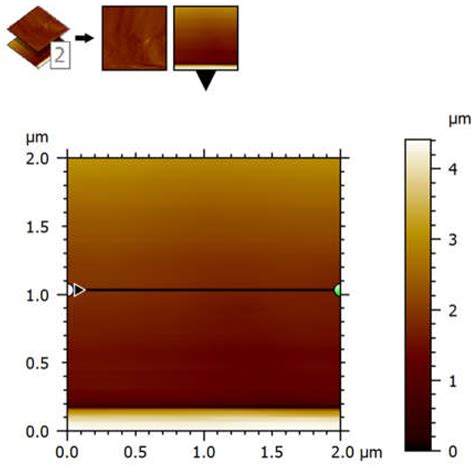 Extracellular Matrix Disorganization at the Mesh–Tissue Interface in ...