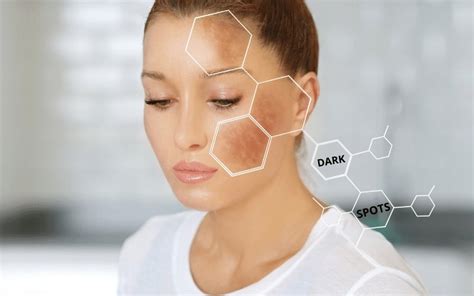 Fighting the Darkest Enemy – THE DARK SPOTS – Blue Nectar