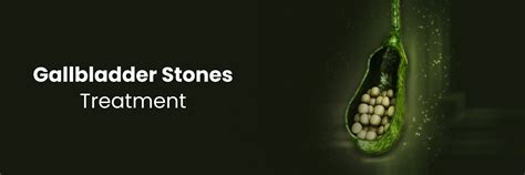 Non-Surgical vs. Surgical Treatments for Gallbladder Stones