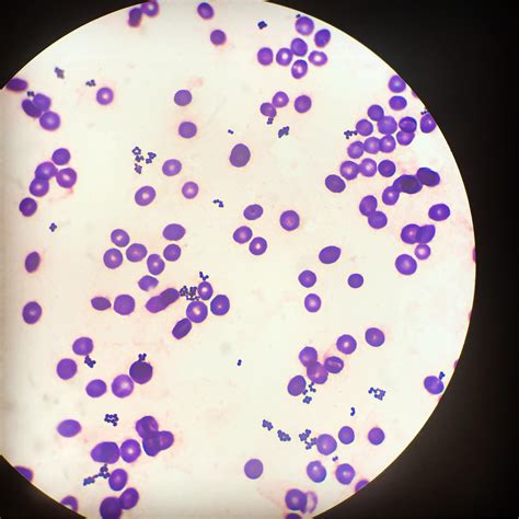 Gram Positive Rods In Clusters