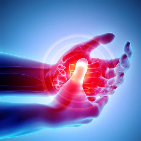Rheumatoid arthritis - Chasing the Cure