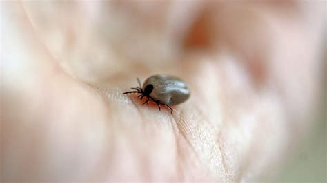 Počela sezona krpelja: Evo savjeta kako se zaštiti i što učiniti ako ...