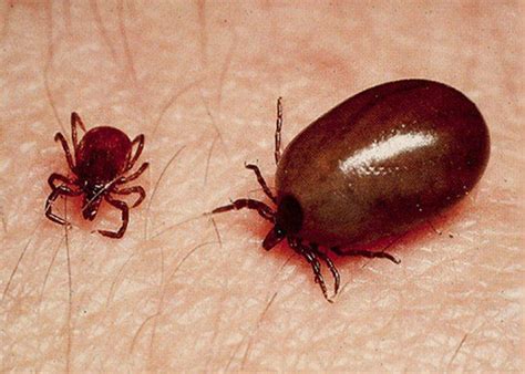 death due to scrub typhus in MP too, if you see these symptoms then go ...