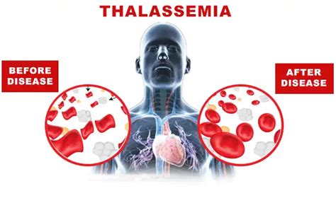 #Best children cancer specialist in Navi Mumbai | Dr Vipin Khandelwal