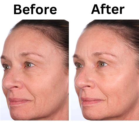 Anti-Aging Repair Serum – Lanera Cosmetics