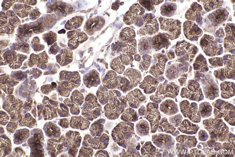 IHCeasy RAB11B Ready-To-Use IHC Kit KHC2501 | Proteintech