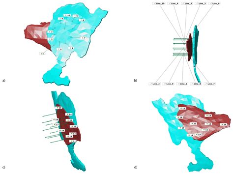 A Novel Digital Technique to Quantify the Area and Volume of Enamel ...