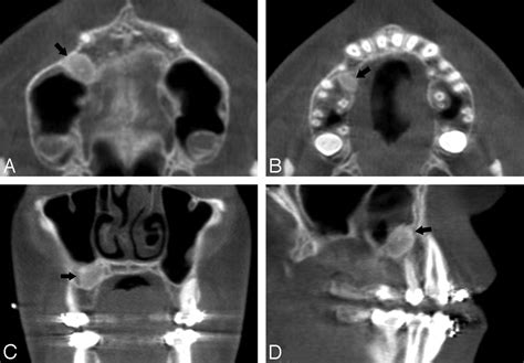 Learn MATLAB for Imaging 的图像结果