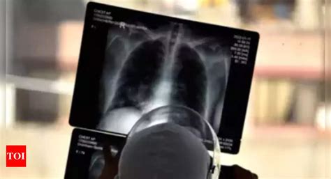 Zoo: UK's heaviest man nearly sent to zoo as he was too big for human X ...