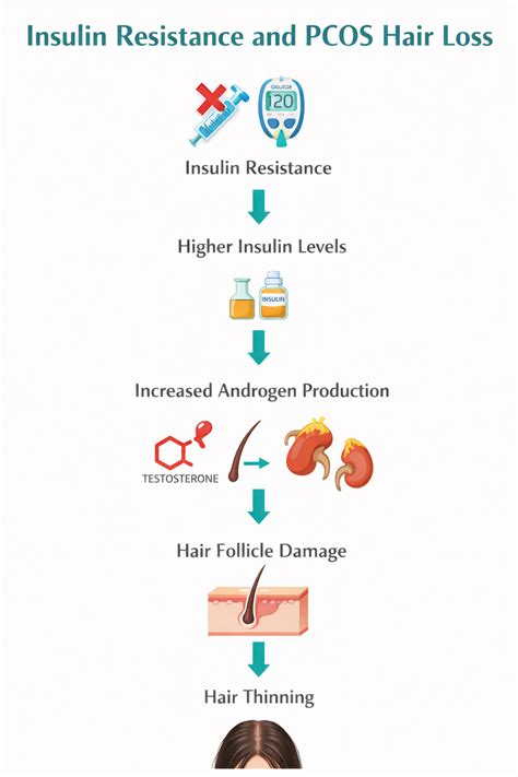 PCOS Hair Loss: Causes, Hormonal Imbalance, Androgen Excess & Treatmen ...