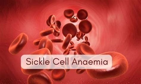 Over 20 lakh from tribal areas screened for sickle cell anaemia in past ...