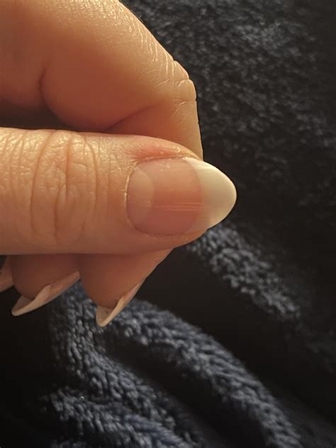 When you can’t pick the French manicure variation so you get 3. What’s your favorite aside from ...