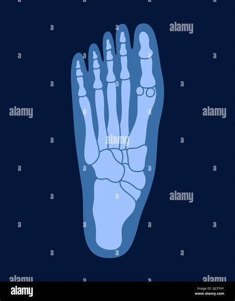 Foot X Ray Anatomy Child at Jaclyn Glenn blog