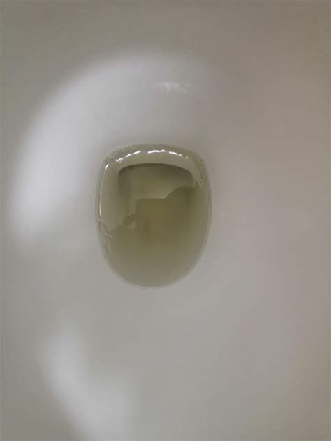 Bubble urine & disappear within 5 minutes. All test neg. Is this normal? : r/foamyurine