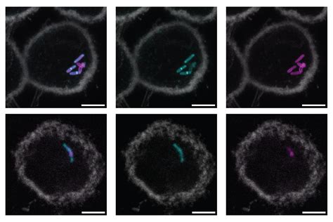 New molecular label could lead to simpler, faster tuberculosis tests ...