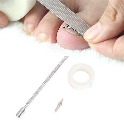 Buy Ingrown Toenail Pedicure Tool Straightening Clip Curved Brace ...