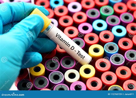 Vitamin D test stock image. Image of care, metals, medical - 112765729