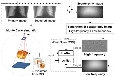 A Deep Learning-Based Scatter Correction of Simulated X-ray Images